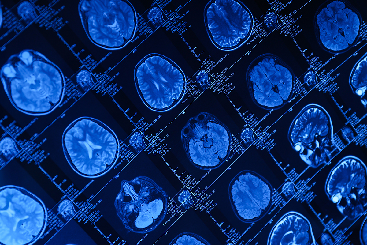 Medical Imaging