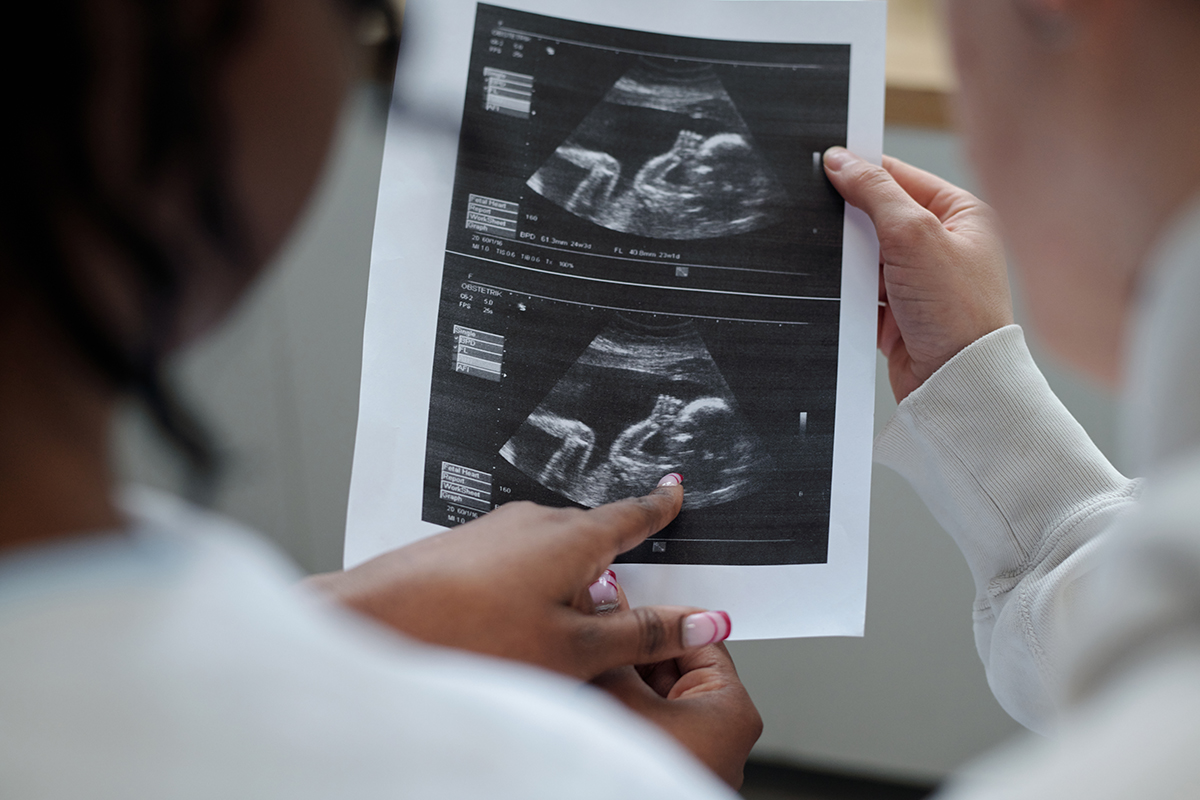 Sonography